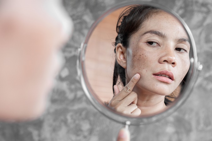 Pakai Skincare Pemutih, Kulit Malah Jadi Gosong? Ini&nbsp;Penjelasannya